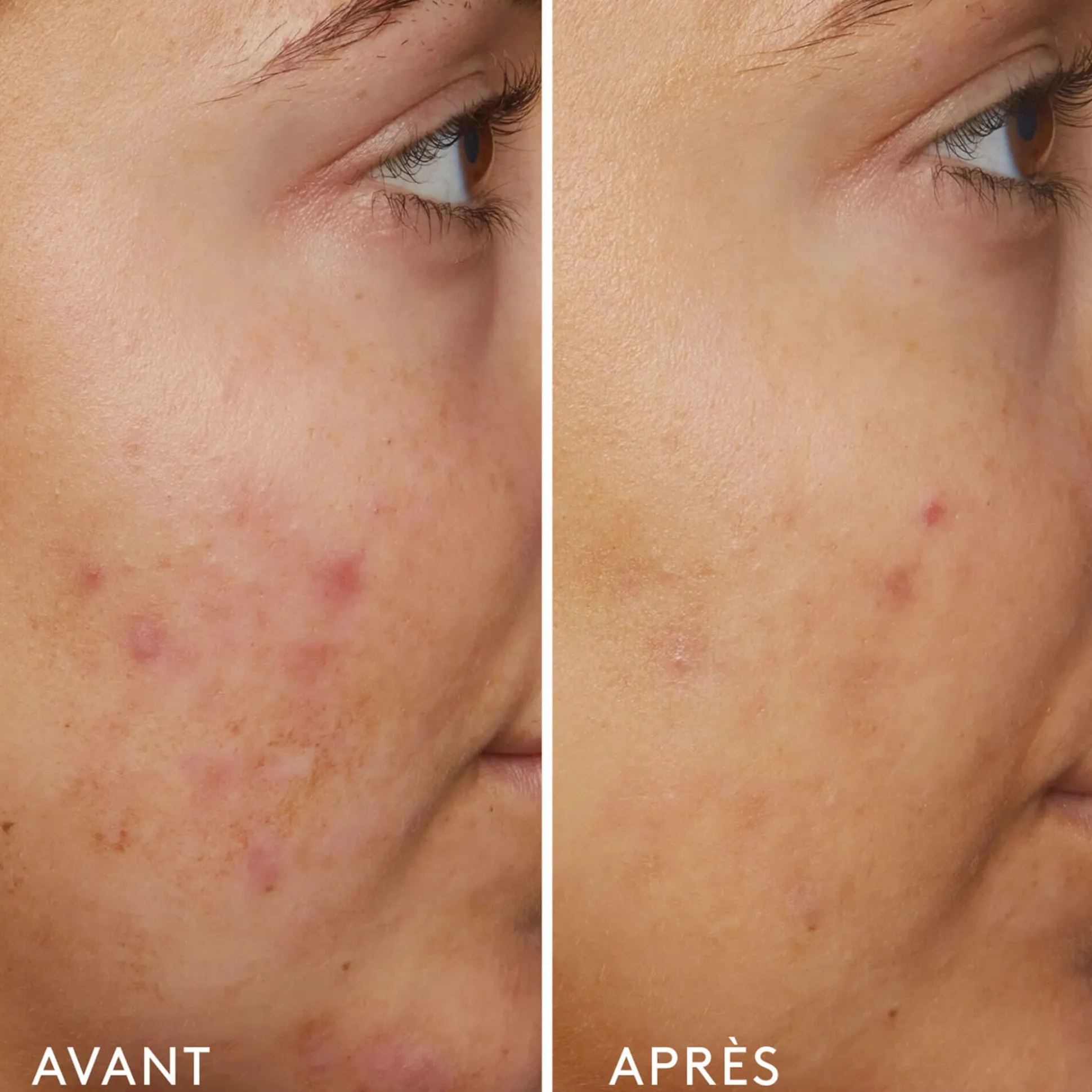 B3 Nice 10% Niacinamide Sérum Rééquilibrant