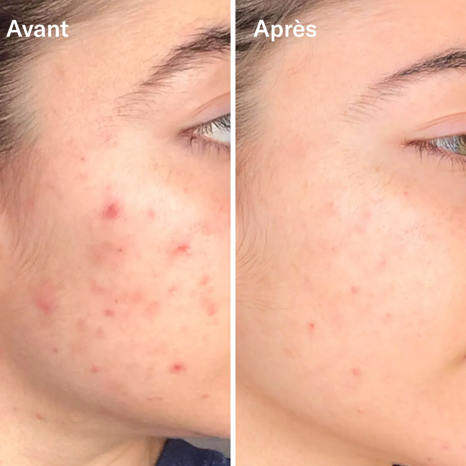 Bl+C Serum Concentré Anti-Imperfections Cumin Noir + Cajeput