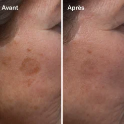 Clean-ical Brightening Serum Sérum Éclaircissant