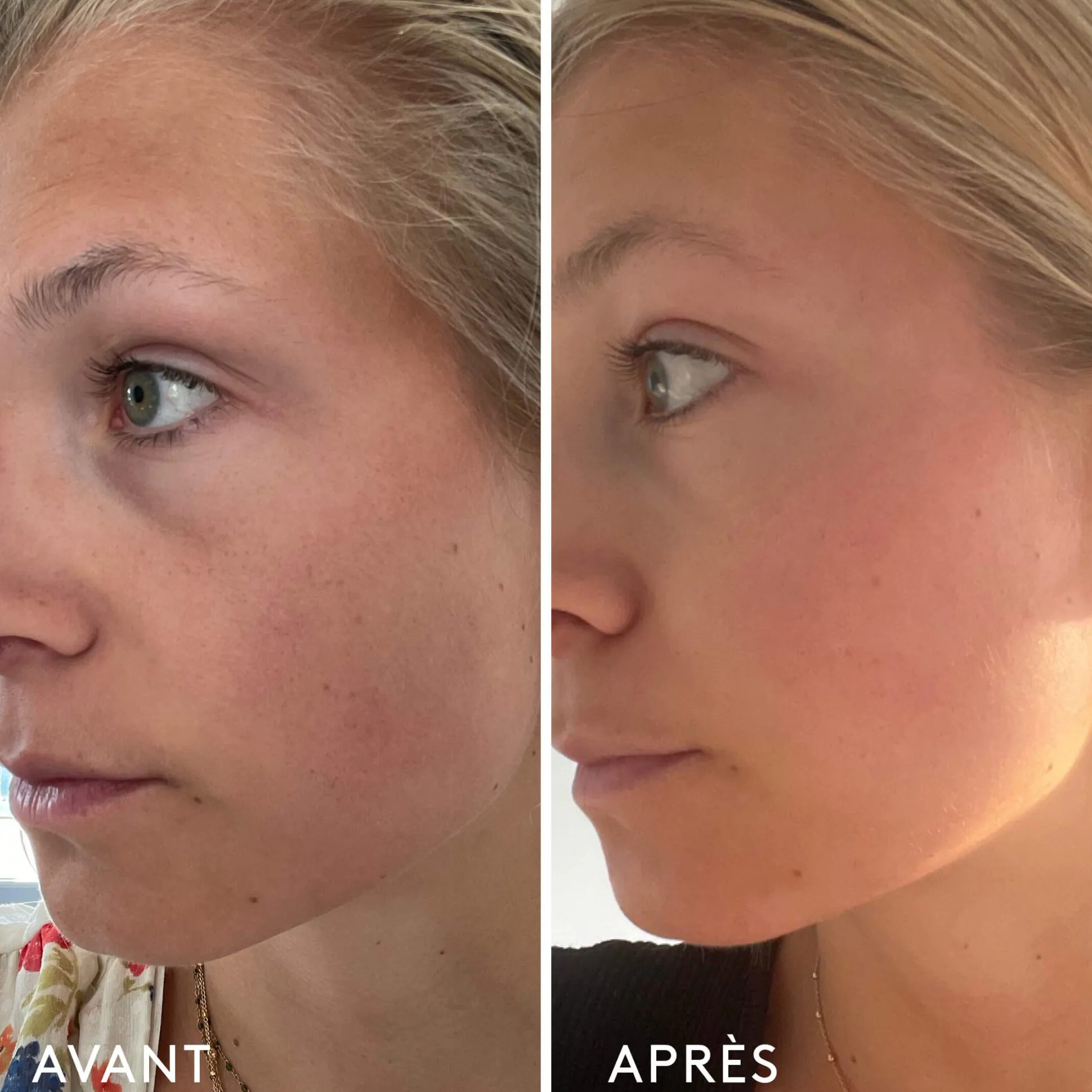 Complément Alimentaire Repulpant