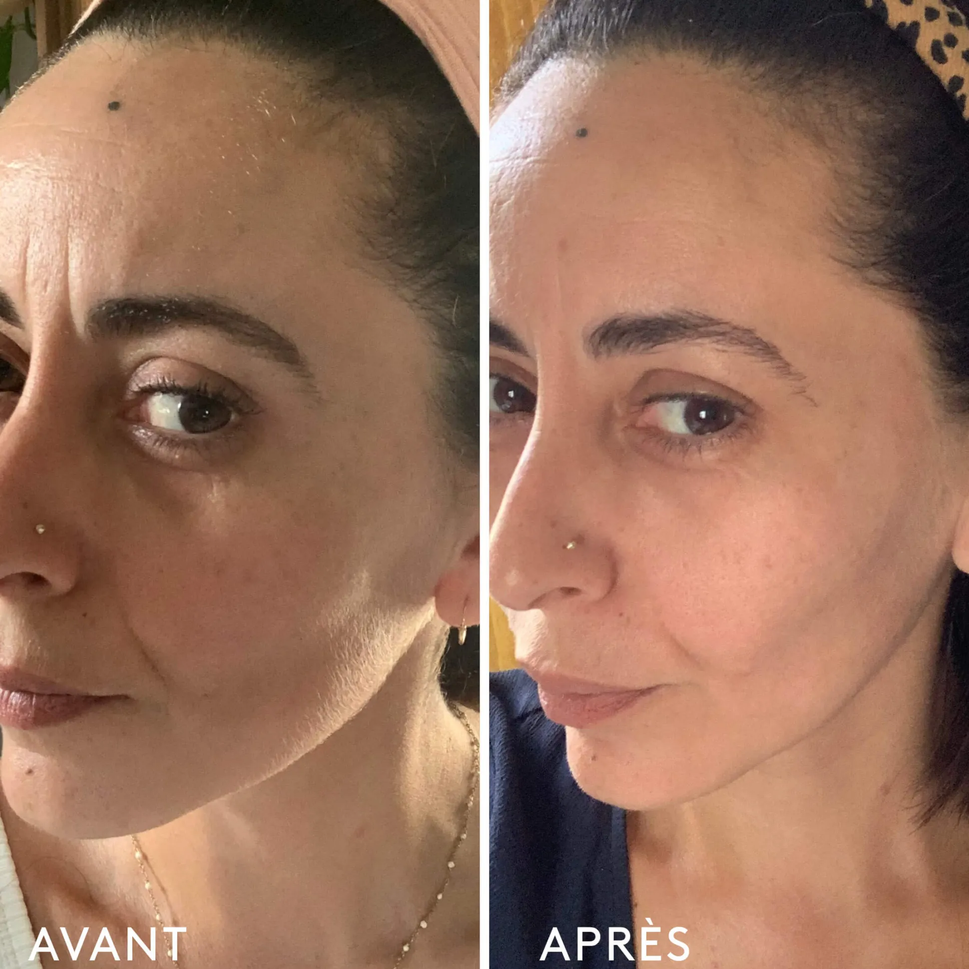 Complément Alimentaire Repulpant