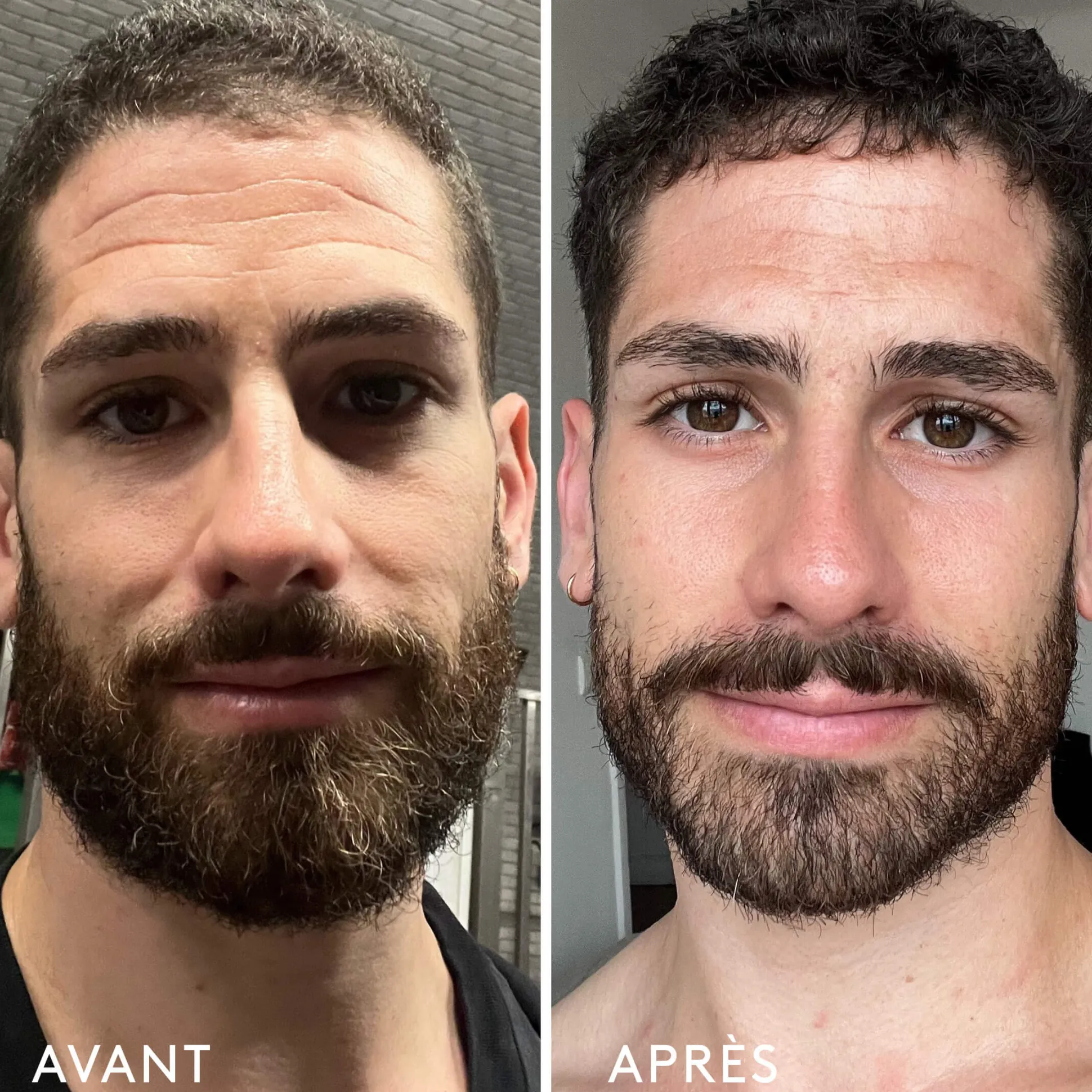 Complément Alimentaire Repulpant