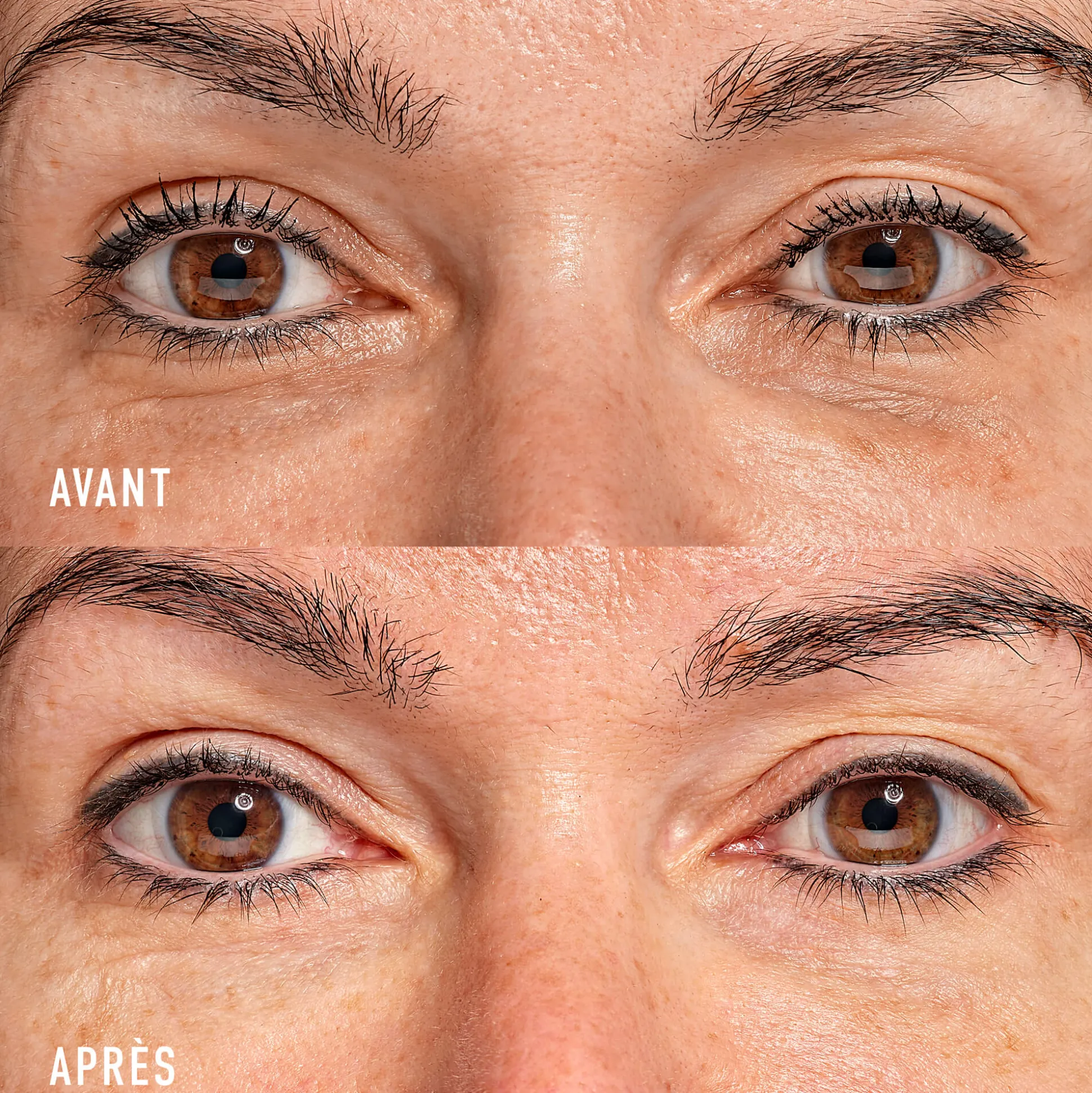 Eye Recipe Soin Contour des Yeux Global