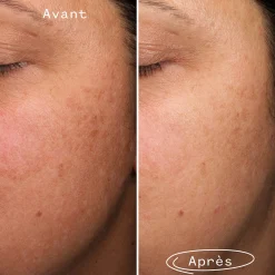 Fade Forward Sérum Anti-Taches