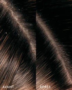 Huile Remède Cuir Chevelu Aceite de Moska Format Voyage