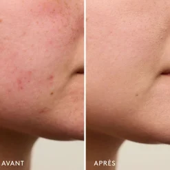 Invisible Bandage Gel Apaisant & Réparateur