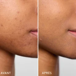 Invisible Bandage Gel Apaisant & Réparateur