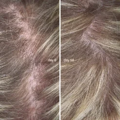 L'Essentiel Cheveux Cure de 3 mois