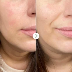 Partners in Calm Kit Nettoyant & Hydratant